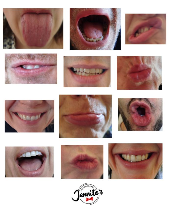 Angers (Fêlés du buccal) mars 2025